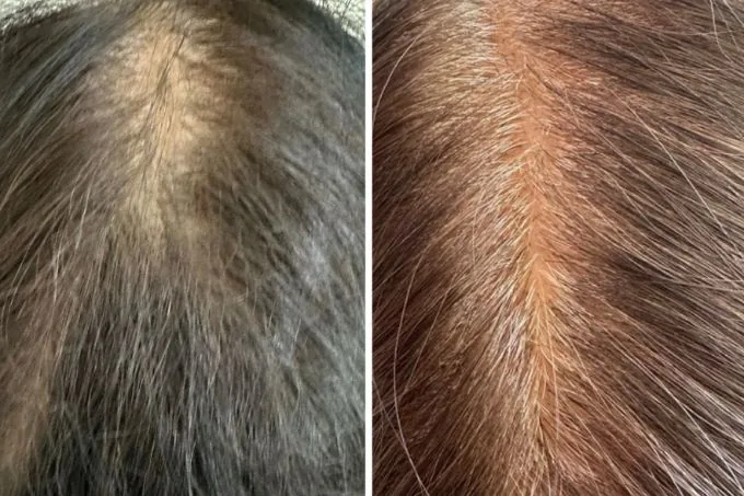 Hair Result
